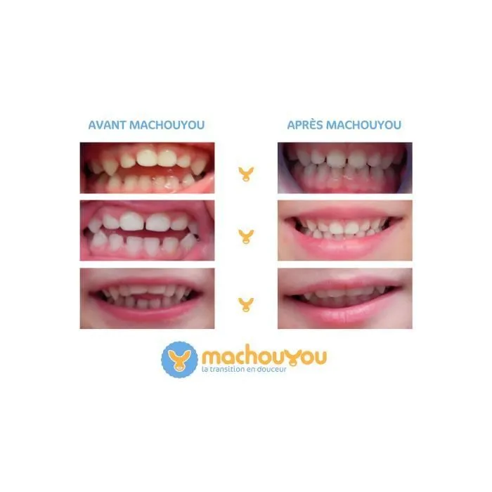 Machouyou Dispositif 1ères dents couleur - Orange-2
